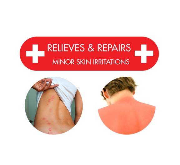 ItchFix Aloe Vera product